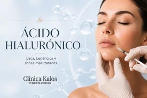acido-hialuronico-usos-beneficios-kalos-estetica