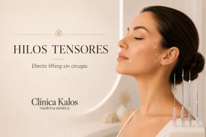 hilos-tensores-lifting-cirugia-kalos-estetica